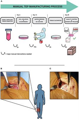 From Single Batch to Mass Production–Automated Platform Design Concept for a Phase II Clinical Trial Tissue Engineered Cartilage Product